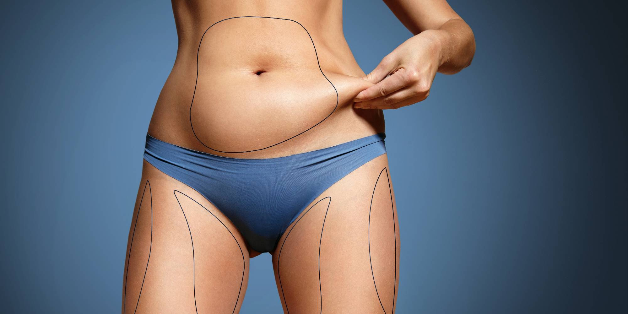 Lipo Não-Cirúrgica